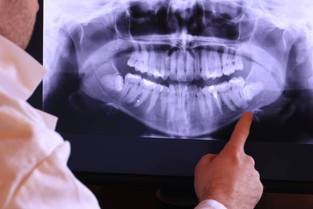 Best Walk-In Emergency Dentist in Papillion, NE