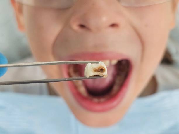 Best Walk-In Emergency Dentist in Papillion, NE