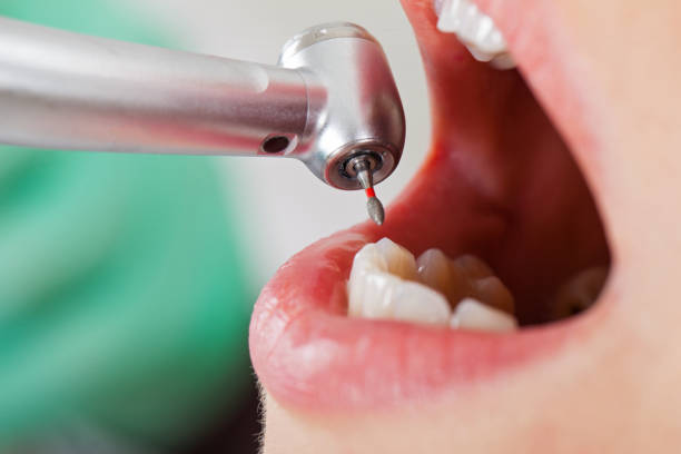 Best After-Hours Emergency Dentist in Papillion, NE